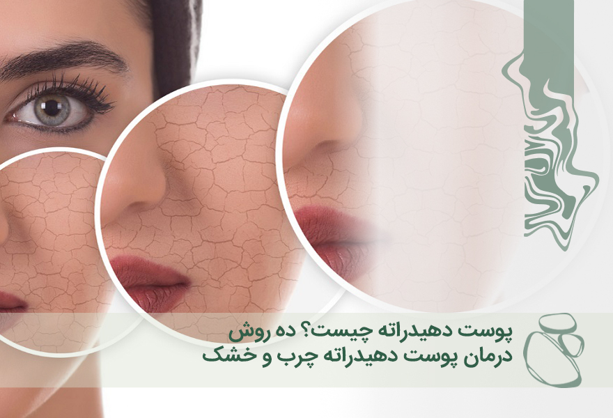 پوست دهیدراته چیست؟ 10 روش درمان پوست دهیدراته چرب و خشک